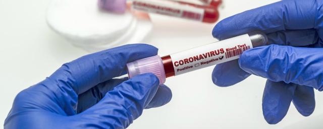 Во Владимирской области выявлен еще 131 заразившийся COVID-19