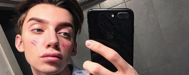 В Москве избили блогеров-геев Петрова и Городецкого