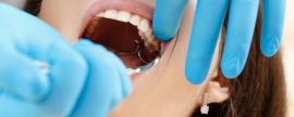 Стоматолог Минко рассказал, когда не стоит удалять зуб