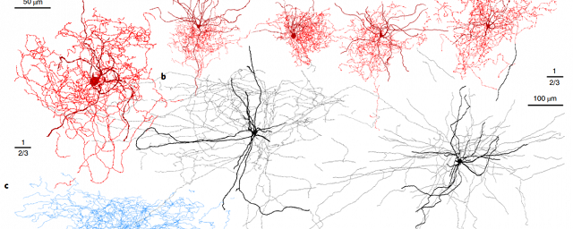Ученые нашли новый тип нейронов в человеческом мозге