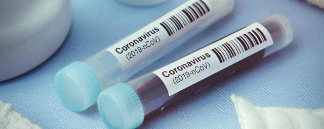 В Томской области выявлены еще 65 заразившихся коронавирусом