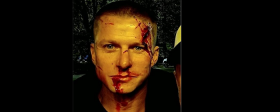 Поклонников напугало фото окровавленного Романа Курцына в Костроме