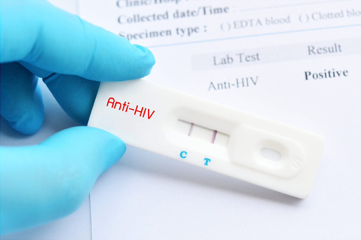 Хабаровчанину, заразившему партнершу ВИЧ, грозит до трех лет лишения свободы