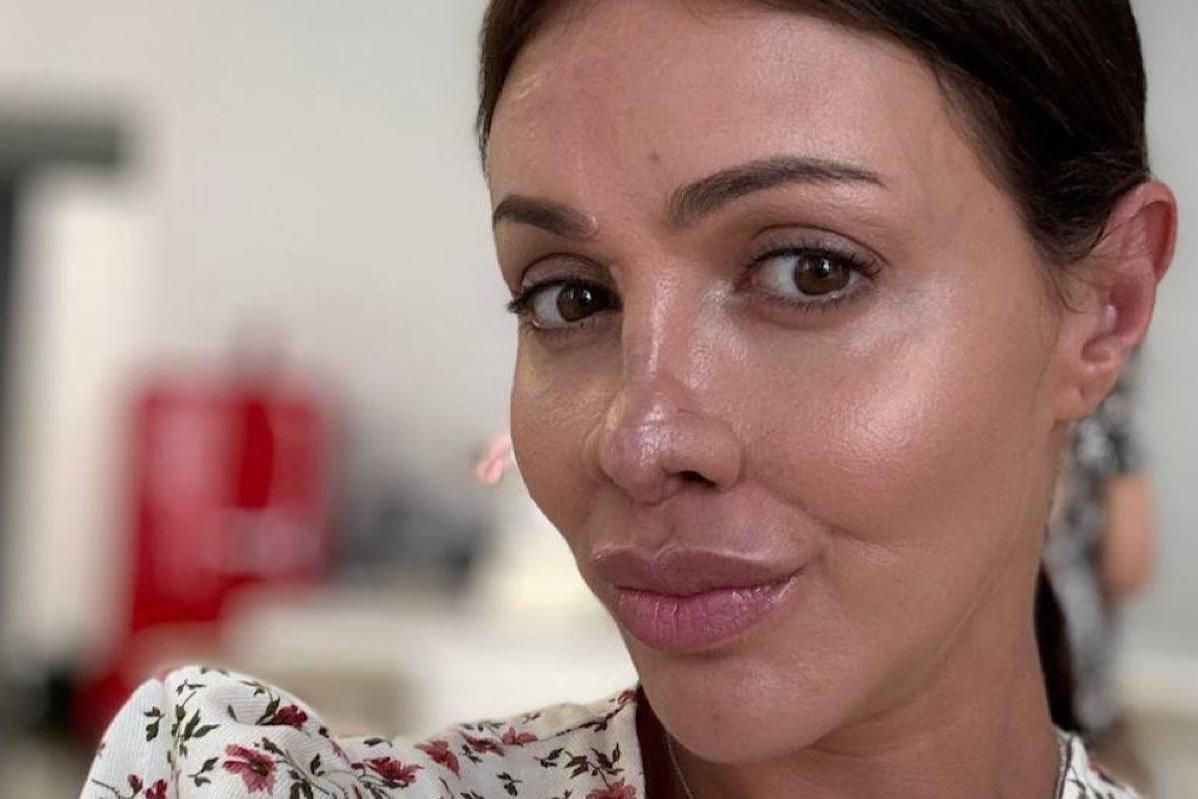 Изуродованная недугом экс-жена Аршавина вновь стала красоткой