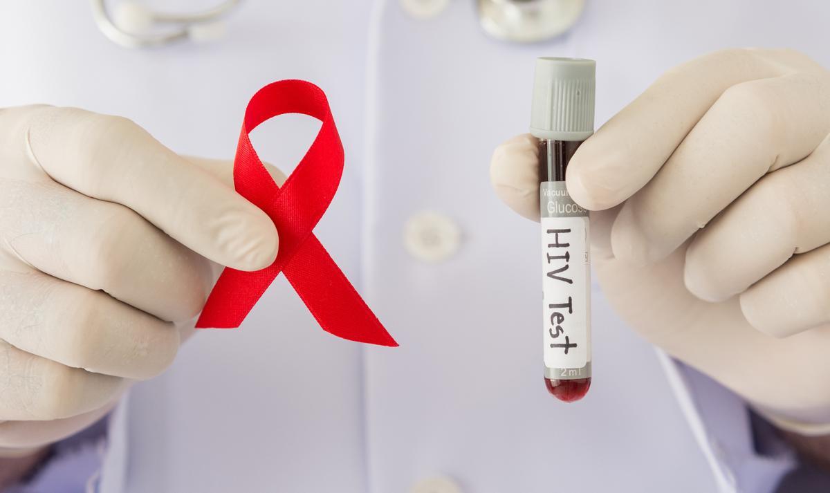 В ХМАО в 2023 году СПИД был выявлен у 213 горожан