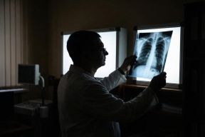 Минздрав России утвердил обновленный стандарт медицинской помощи при туберкулезе