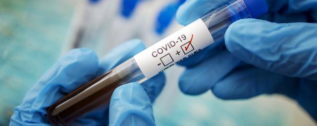 В Белгородской области обнаружены 93 новых заразившихся коронавирусом