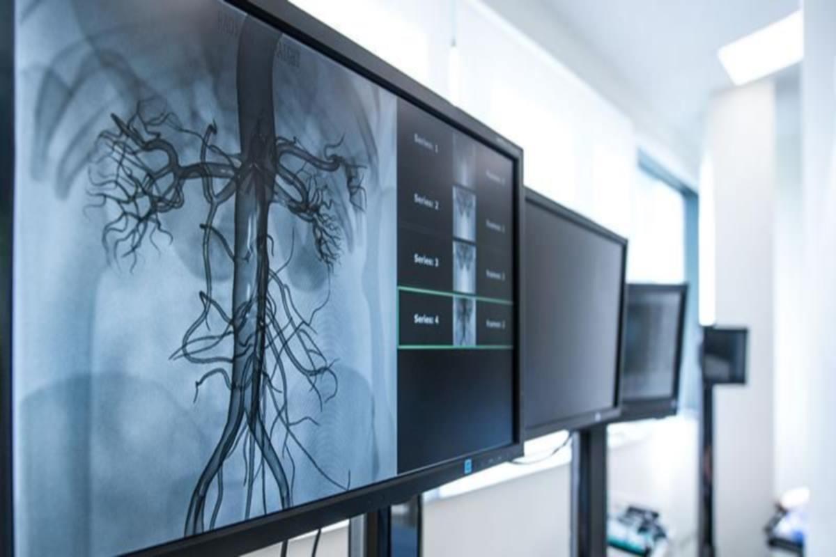 Московские специалисты научили ИИ прогнозировать заболевания сердечно-сосудистой системы у пациентов