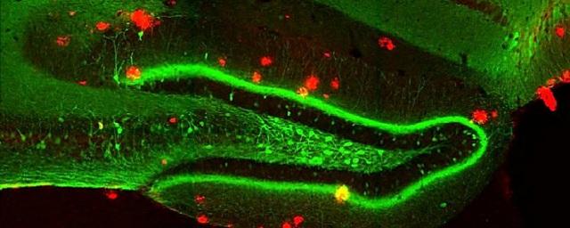 Ученые: Стертые болезнью Альцгеймера воспоминания можно восстановить