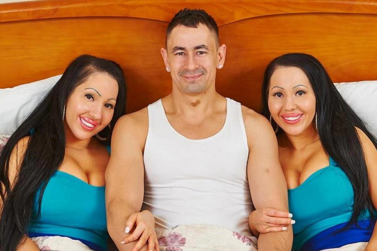 Одна внешность, одна болезнь и один муж. Как живут самые похожие в мире близняшки