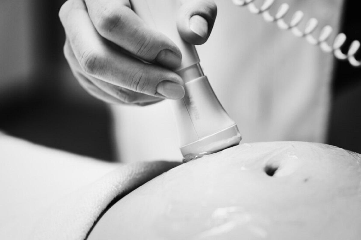 23-летняя россиянка (страна-террорист) скончалась во время родов из-за осложнений на фоне инфекции