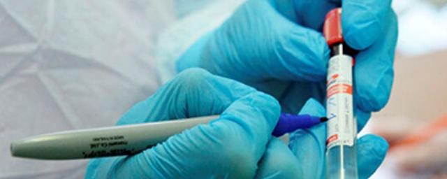 В Свердловской области выявлено 367 случаев коронавируса за сутки