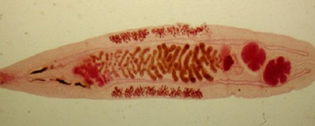 Российские ученые используют опасного печеночного паразита для заживления кожных ран