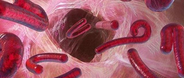 Science Translational Medicine: вирус Эбола способен сохраняться в организме и возобновить болезнь через годы