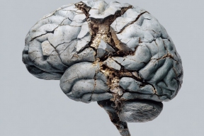 5 Habits That Are Threatening Your Cognitive Health