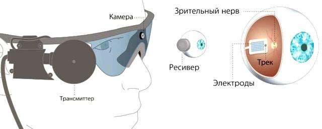 В России впервые установили бионический глаз слепоглухому человеку