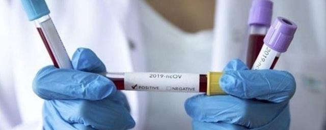 За прошедшие сутки в Амурской области зафиксировано 27 новых случаев коронавируса