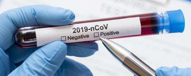 В Новосибирской области подтверждено еще 102 случая коронавируса