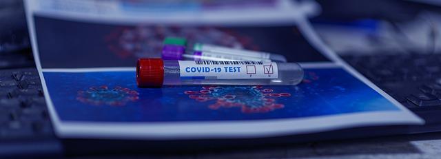Раскрыты результаты тестирования на антитела к COVID-19