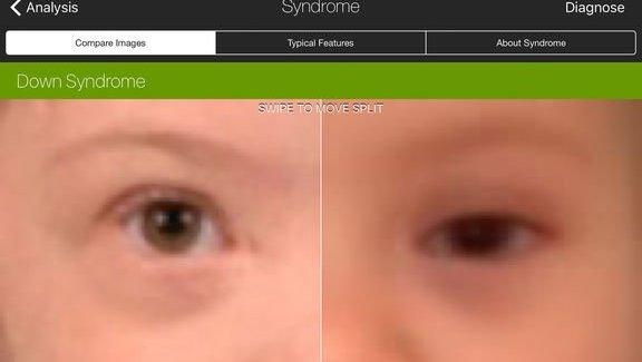 В США компьютер поставил диагноз по фото быстрее врачей
