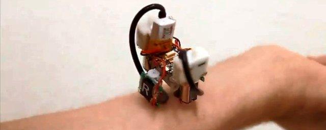 Ученые создали робота на присосках для обследования кожи