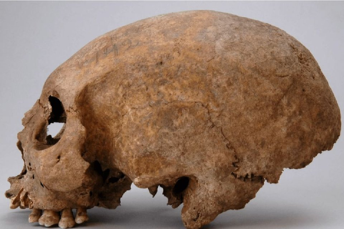В Швеции обнаружили аномально вытянутые черепа женщин эпохи викингов