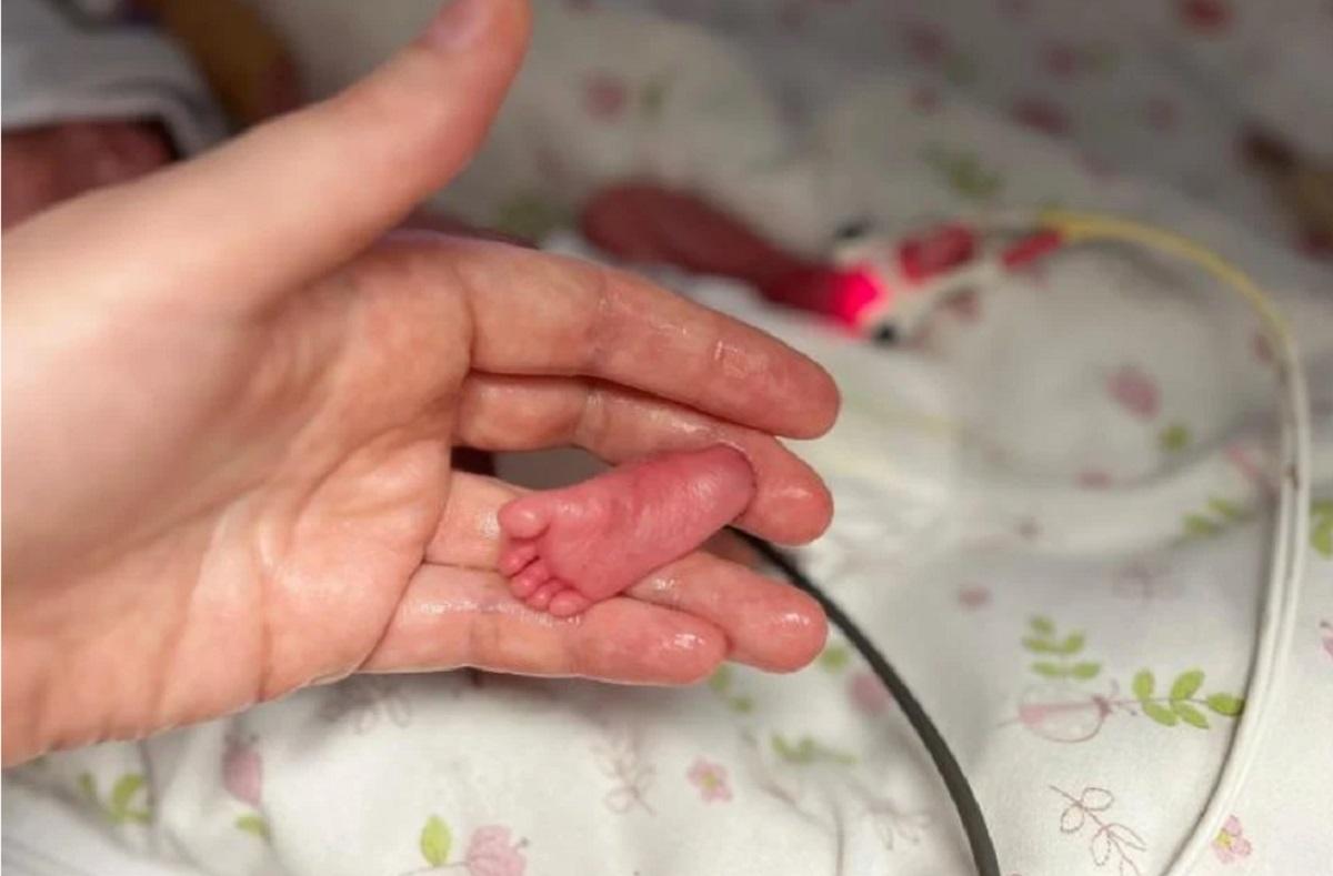Родилась настоящая дюймовочка: В Уфе врачи перинатального центра спасли жизнь новорожденной