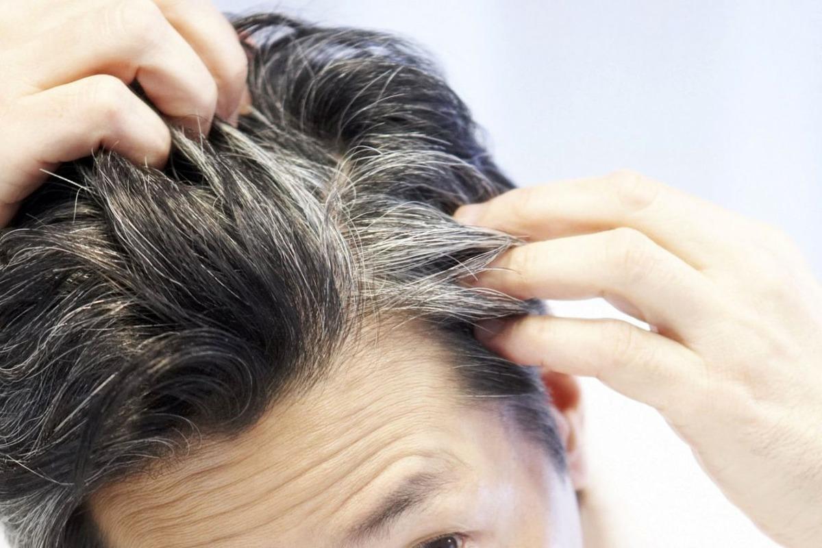 Врачи рассказали, о каких болезнях могут сигнализировать седые волосы в молодом возрасте