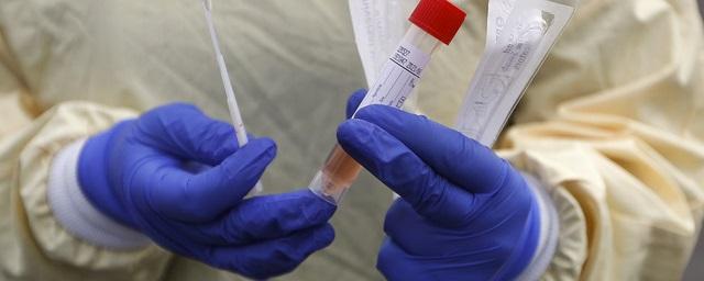 Еще 24 человека заразились коронавирусом на Колыме