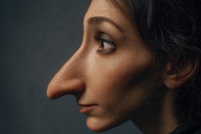 Работа над самооценкой: как избежать эффекта «ожидание/реальность», решившись на пластику?