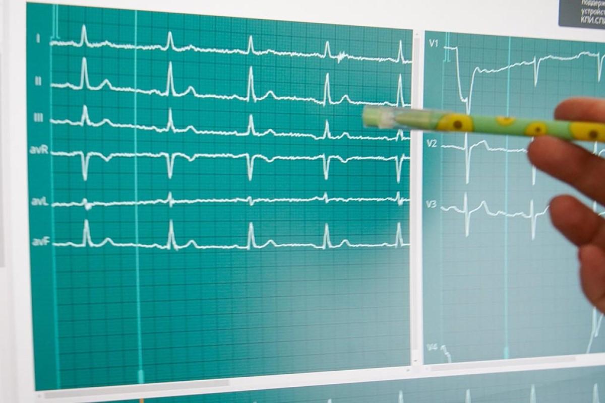 Кардиолог Кондрахин рассказал, как выявить болезни сердца на ранней стадии