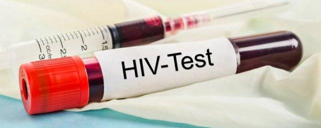 Argentine woman is second in the world to completely overcome HIV without treatment