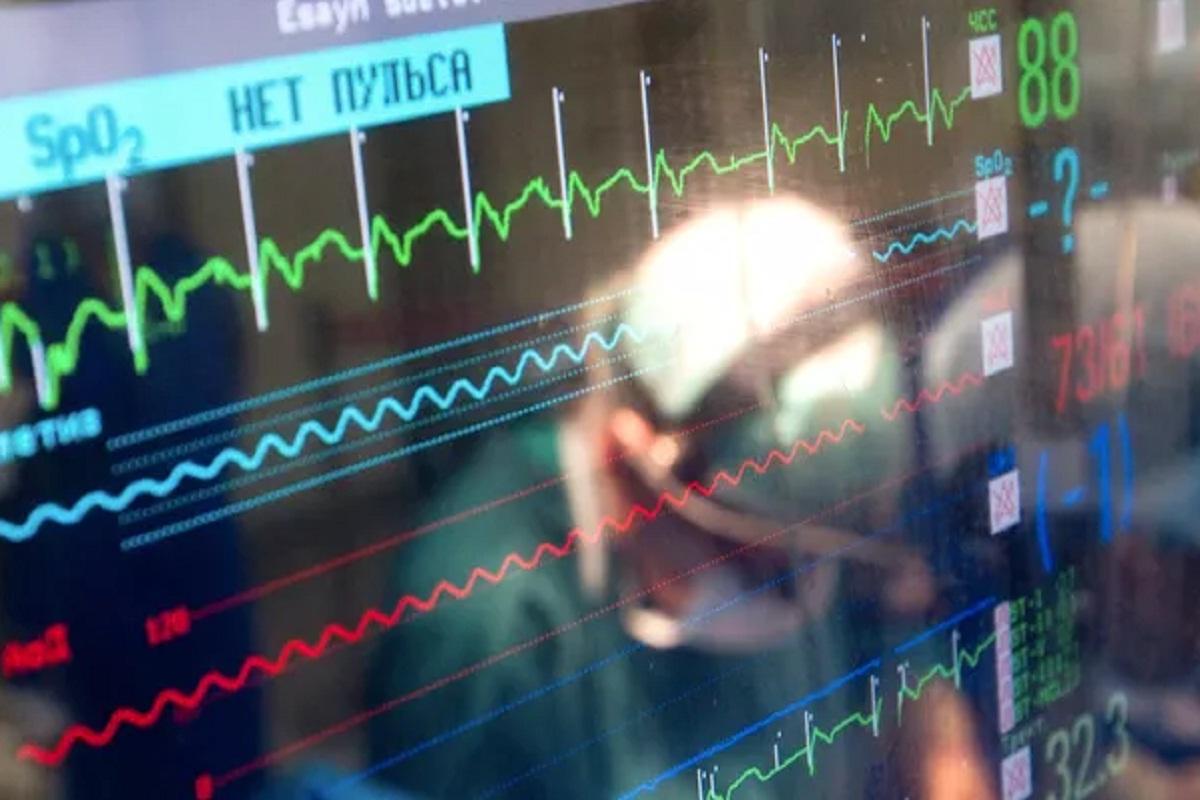 Ученые из Китая научились диагностировать мерцательную аритмию по радиоволнам