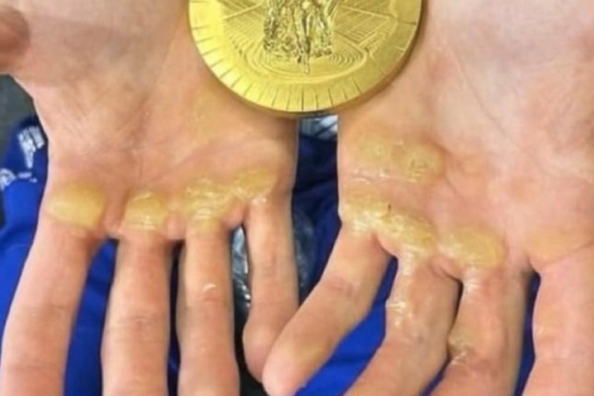 Олимпийский чемпион из Румынии показал качество своей медали