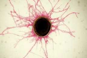 Ученые нашли связь между бактериями в полости рта и болезнями сердца