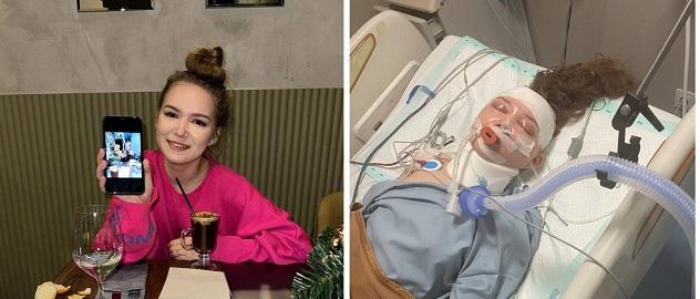 Жительница Новосибирска уже неделю не приходит в сознание после ДТП на Бали  