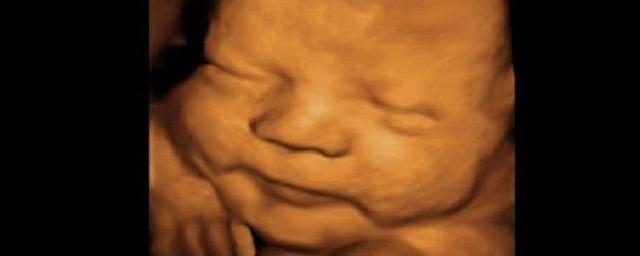Потрясающие фото развития малышей в утробе матери