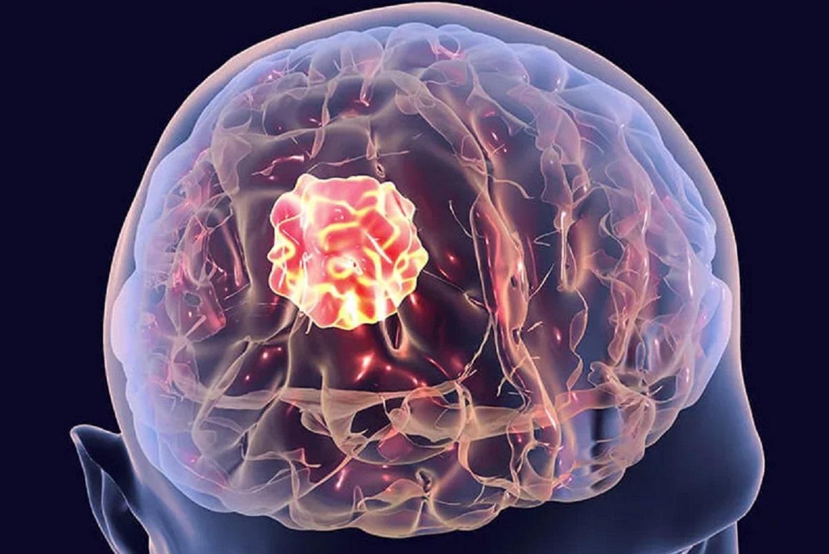 Новосибирские ученые нашли способ подавления раковых клеток мозга при помощи соединения СПМА