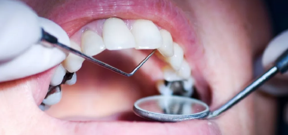 Стоматолог Трифонова: Невылеченные зубы приводят к проблемам с другими органами