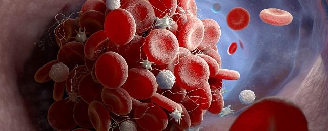 Ученые: COVID-19 способен менять клетки крови человека