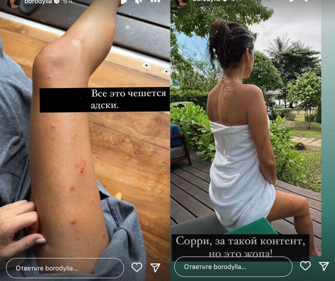 Ксения Бородина сообщила, что в Таиланде её покусали мухи