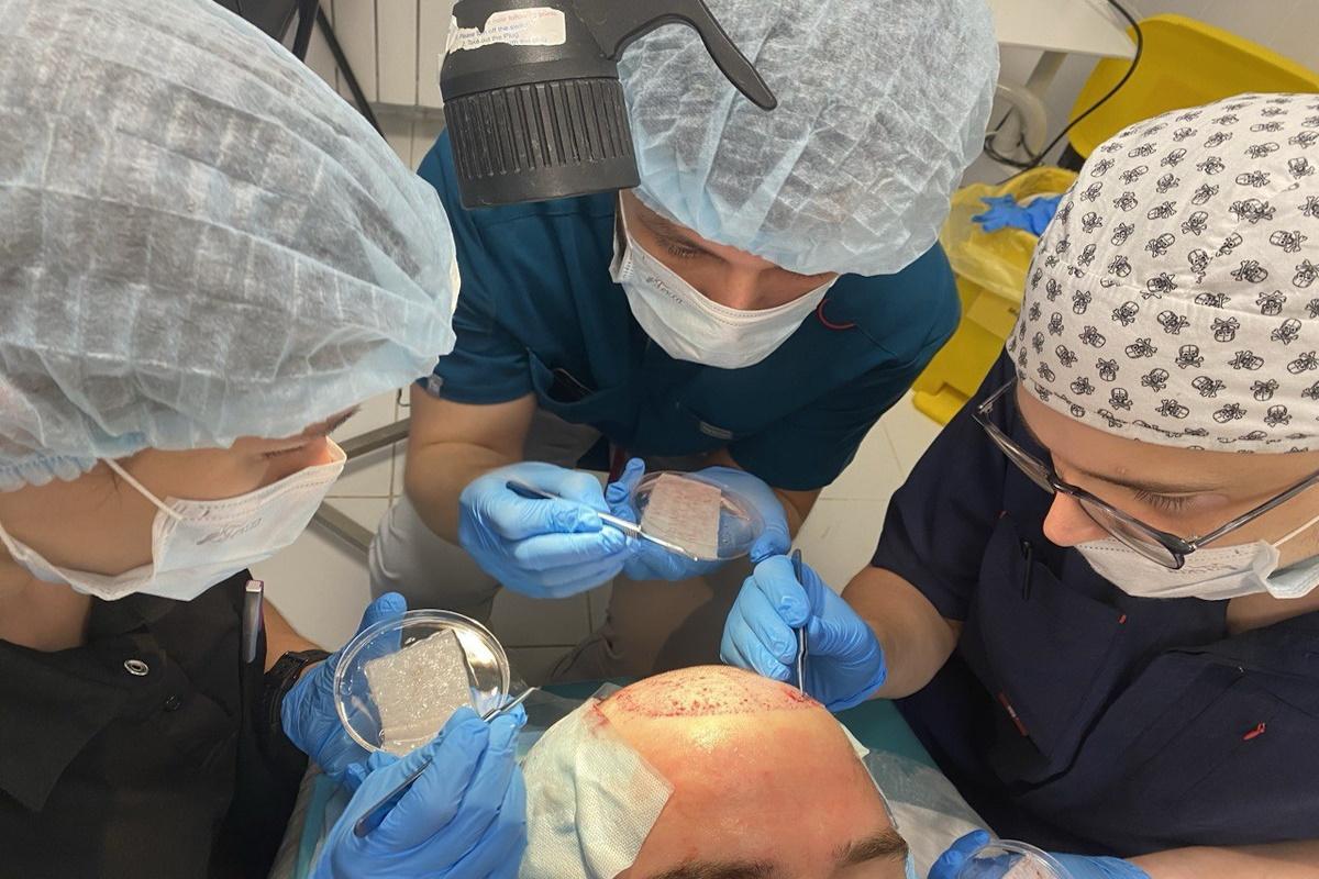 В Самаре начали выполнять операции по пересадке волос с применением современной FUE-технологии