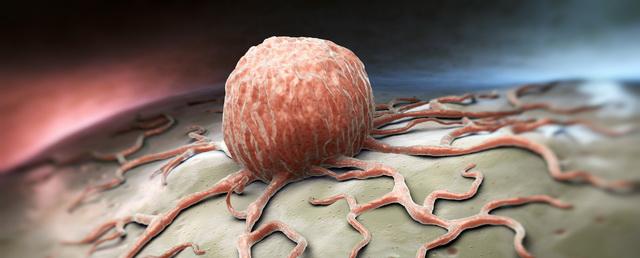 Как не допустить появление рака, как выявить онкологию на ранних стадиях, советы и рекомендации
