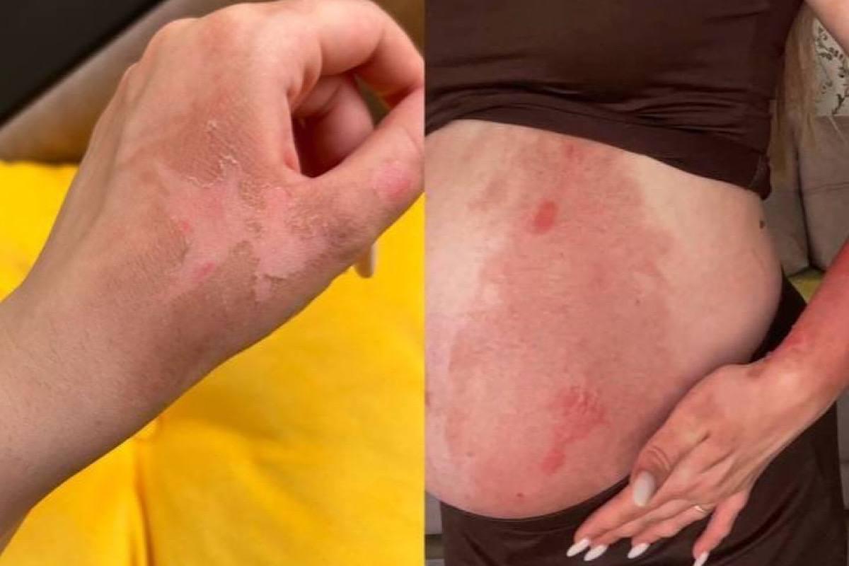 В Георгиевске у беременной женщины в руках взорвался блендер