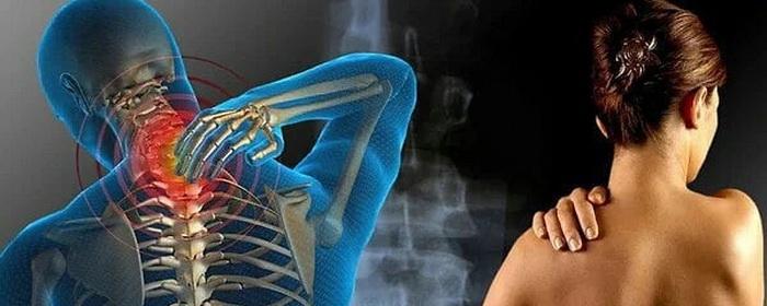 Невролог Юлия Березина рассказала, как определить причину болей в спине, пояснице и шее