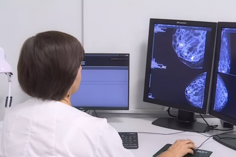 Референс-центры в Вологодской области обрабатывают более 150 тысяч снимков в год