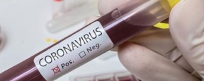 В Ленинградской области выявлено 63 новых случая коронавируса