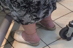 В Костромской области хирурги быстро поставили на ноги 85-летнюю женщину с переломом шейки бедра