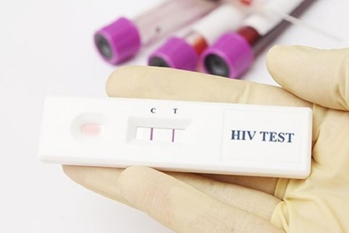 Появилась статистика по числу ВИЧ-положительных в Вологодской области