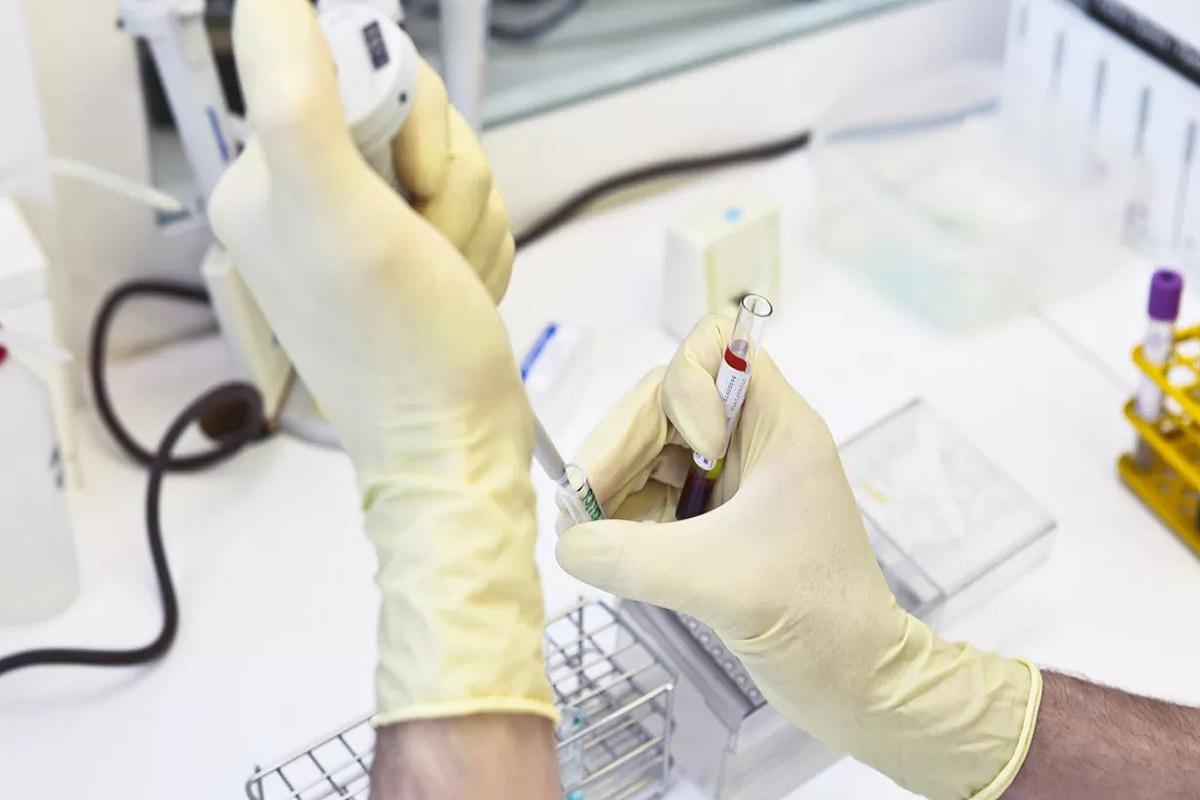 Попова: Разработанный в России тест на холеру находится на стадии регистрации